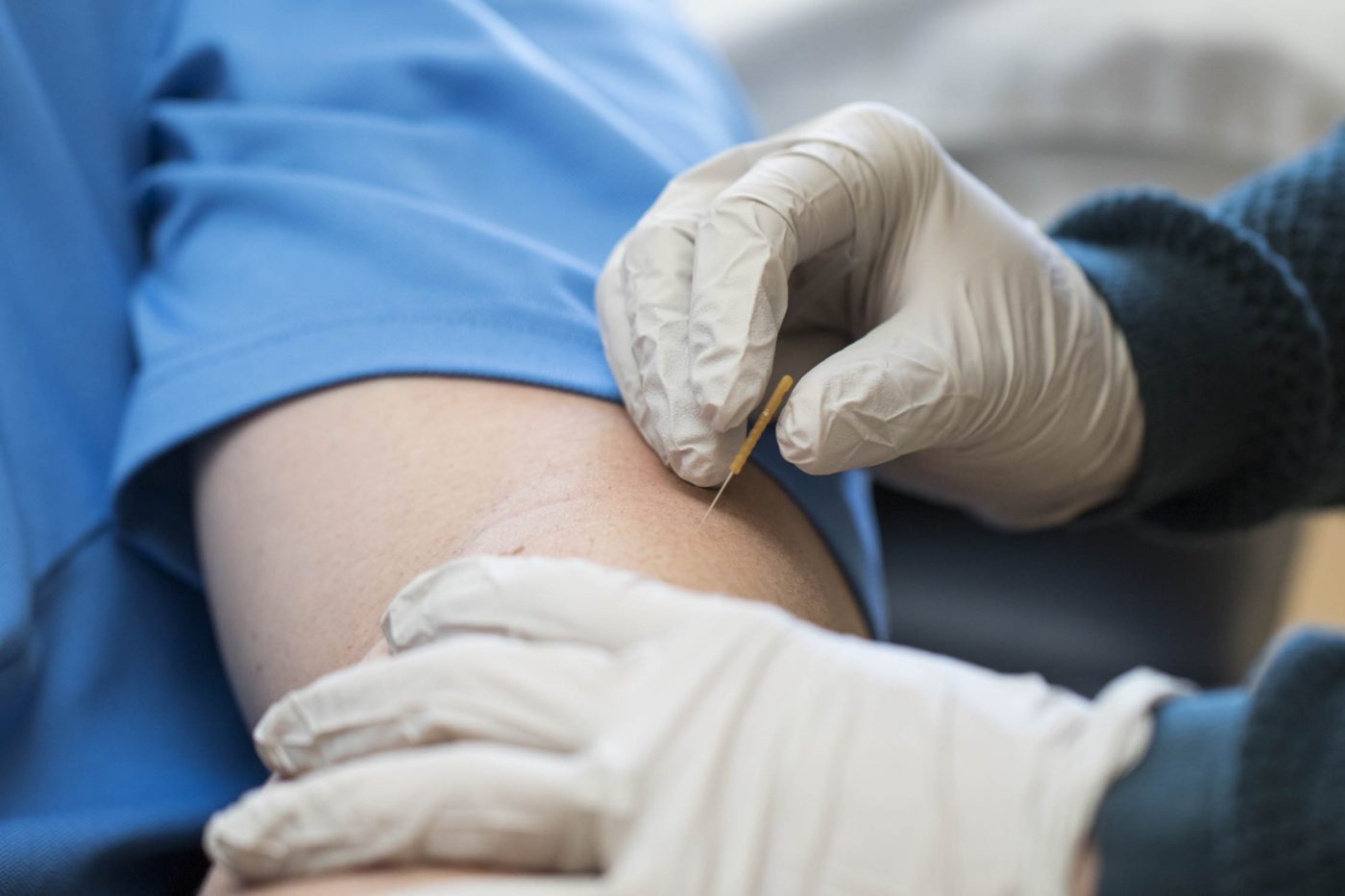 Trigger point dry needling advantage rehab physical therapy in cody wy